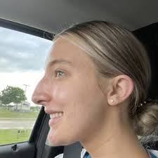 TOP 10 BEST Lipoma Removal in Plano, TX