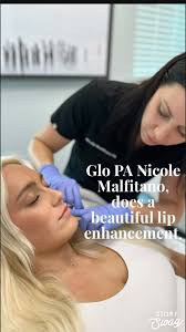 PA Nicole Malfitano,, starts Friday off beautifully!, Nicole used a half of  syringe of Restylane to build up