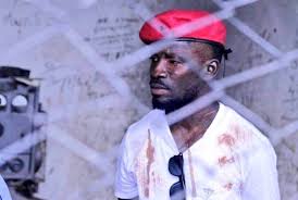 We did not find results for: Karen Nyamu On Twitter Kagutamuseveni Should Know That Using Torture Inhuman And Degrading Treatment To Silence Dissenting Voices In This Day And Age Is Totally Unacceptable Freebobiwine Https T Co Oneb5g30n0