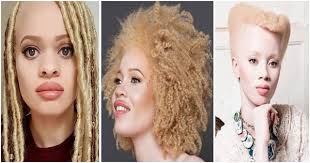 Pearl blonde highlights will make you look unforgettable, while the comfortable length and variety of styling ideas will definitely extend the scope of your imagination! 9 Hairstyles Ideas For Albino Women Afroculture Net