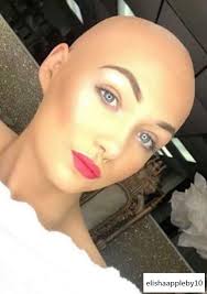 Alopecia Areata Teen Model Inspires As Wig Brand Ambassador