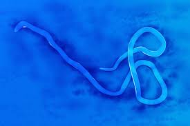 5 Viruses That Are Scarier Than Ebola Live Science