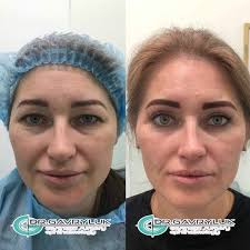 Українці в Албанії