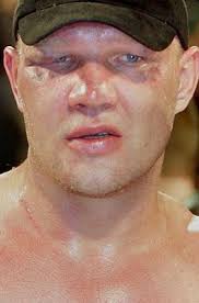 He is best known for his 1995 showing against george foreman in a bout that many observers thought he won. Axel Schulz Alchetron The Free Social Encyclopedia