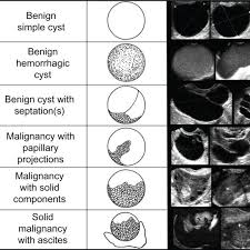 They are common and usually form during ovulation. Sonographic Images Of Benign And Malignant Ovarian Morphology Numeric Download Scientific Diagram