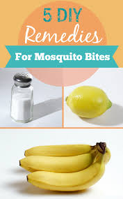 5 Diy Remedies For Mosquito Bites Remedies For Mosquito Bites Remedies Diy Remedies