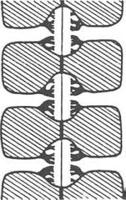 Image result for Calycosiphonia spathicalyx