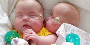 Teenage pregnancy could be a setback to your life. Born At 22 Weeks Twin Micropreemies Among Youngest To Survive