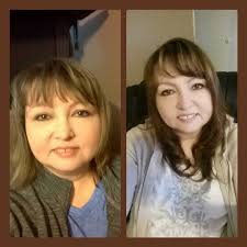 After losing 30 lbs, I think my face is less puffy.