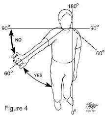 Failed Rotator Cuff Repairs Johns Hopkins Department Of