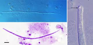 Image result for what do Mallophaga look like in dog fur