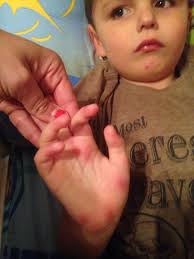 What do you think of Levi's face?