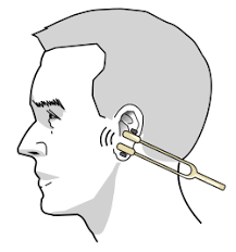 Image result for Tuning Fork Test