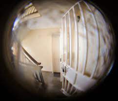 Peripheral Vision Loss: Causes, Diagnosis, & Treatment Options - Ideal  Eyecare