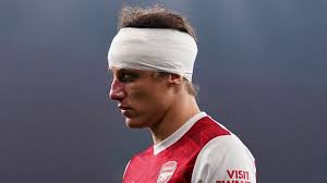 22 premier league loss against chelsea. Ryan Mason Footballers Guilty Of Being Too Brave Over Head Injuries Football News Sky Sports