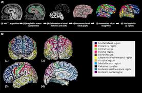 Borradori is a specialist in social and political theory, aesthetics, and the philosophy of terrorism. Neurodevelopmental Subtypes Of Bipolar Disorder Are Related To Cortical Folding Patterns An International Multicenter Study Sarrazin 2018 Bipolar Disorders Wiley Online Library