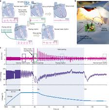 How do pacemakers regulate arrhythmias? Symbiotic Cardiac Pacemaker Nature Communications