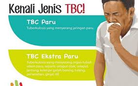 The company provides an integrated series of services in operations & construction, facility management, investment & asset management, and privatization & vision 2030. Ini Sebabnya Orang Lebih Takut Virus Corona Dibanding Tuberkulosis Kabar24 Bisnis Com