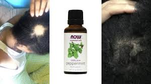 Maple holistics pure peppermint essential oil works on hair growth and can be used as a perfect massage oil to relieve stress, to hydrate the skin body wonders 100% pure peppermint essential oil is of versatile use. Peppermint Oil For Hair Growth Results Youtube