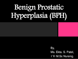 Tools and downloaders to help you and make your life easier beyond the limits! Benign Prostatic Hyperplasia Bph