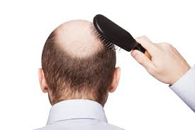 Tel aviv, israel — hearing loss is the most form of sensory disability in the world.of the millions who deal with this issue, about half the cases of deafness are the result of genetic mutations. Side Effect Of An Old Drug Inspires New Hope For Treating Hair Loss