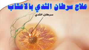 علاج سرطان الثدي طبيعي ا بالأطعمة والمشروبات بدون أي مواد كيميائية