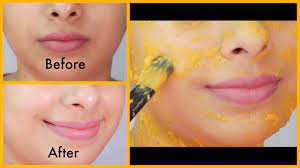 If you are looking for quick results in just 2 weeks, then you may have to consult a dermatologist. How To Get Flawless Glowing Fairer Ageless Skin In 1 Week Youtube