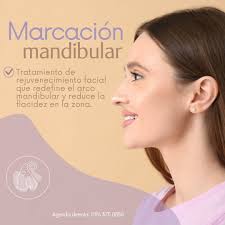 Marcación Mandibular con Ácido Hialurónico ✨ Realza tus facciones con  naturalidad ✨ ¿Sabías que con la marcación mandibular puedes lograr una  apariencia más definida y armónica? Con ácido hialurónico logramos esculpir  tu