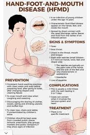 Image result for Hand foot and mouth disease HFMD roof of mouth