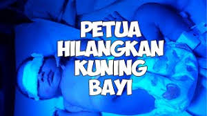 Coba cara menghilangkan noda kuning di baju satu ini. Petua Hilangkan Kuning Bayi Youtube
