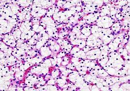 This protocol is applied in the routine staining of cationic and anionic tissue components in tissue sections. Hematoxylin And Eosin Staining Protocol Principle Procedure Results Histopathology Practicals Tissue Types Renal Cell Medical Laboratory Science