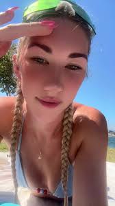 Dealing with Sunburn: My Experience & Lessons Learned