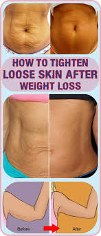 Pin On Healthy Living