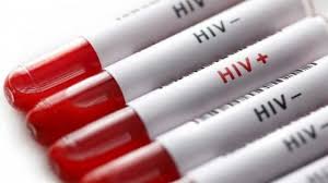 Learn vocabulary, terms and more with flashcards, games and other study tools. Aids Torino Fra Le Citta Capofila Nella Lotta All Hiv La Repubblica