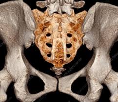 We did not find results for: Rear Of Pelvis And Base Of Spine 3d Ct Scan Stock Image C037 1514 Science Photo Library