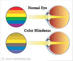 Color Blindness Calculator Color Blindness Self Assessment Test