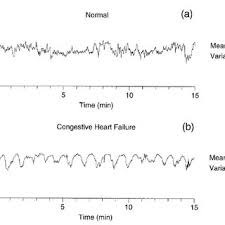 Your heart rate is an important number to know. Comparison Of A Healthy And B Unhealthy Heart Rate Dynamics Download Scientific Diagram