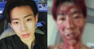 He is an actor and composer, known for untitled jay park project, the truth about meeting women (2015). Tw Cw Jay Park Unexpectedly Frightens Fans With A Gory Selfie On Instagram Allkpop