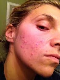 Are vegan foods like these healthy for skin?