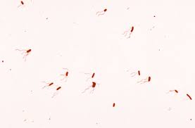 Eleven cats from 10 different households or catteries were diagnosed with bordetella bronchiseptica (b. Bordetella Wikipedia