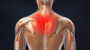 Neck muscles help support the cervical spine and contribute to movements of the head, neck, upper back, and shoulders. Upper Back Pain