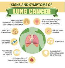 Early warning signs of lung cancer. Signs And Symptoms Of Lung Cancer Vector Images Over 150