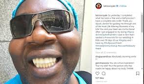 Baby teeth hold space for permanent. Latrice Has A New Smile Rupaulsdragrace