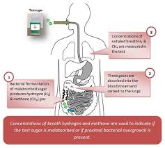 The Beginners Guide To Sibo Antibiotics And Diet