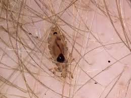 Image result for lice vs nits