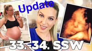 Wie es mir bis zur 34. Schwangerschaftsupdate 33 34 Ssw 3d Bild Kinderklinik Gebarmutterhals Weiter Verkurzt Youtube