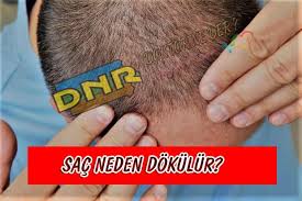Kisa Surede Sac Gurlestirme Dogal Yontemler Saglik Makaleleri Hamster