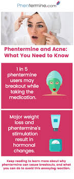 Phentermine Acne Breakouts Causes And Treatments Phentermine Com