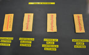 4 4 suture removal clinical procedures for safer patient care