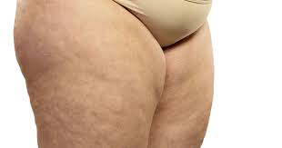 Combine this meal plan with exercises and home treatments and you will get rid of cellulite in no time. 6 Exercises That Will Help You Reduce Cellulite In 2 Weeks